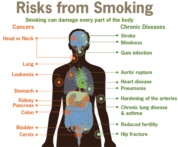 List Of Diseases Caused By Smoking Conditions Caused By Smoking