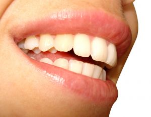 upper lip hair removal
