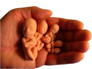 abortion