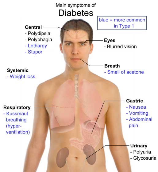 top-diabetes-indicator.jpg