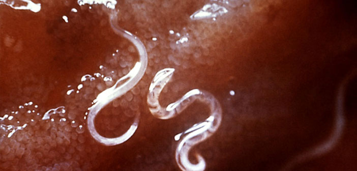 Intestinal Worms