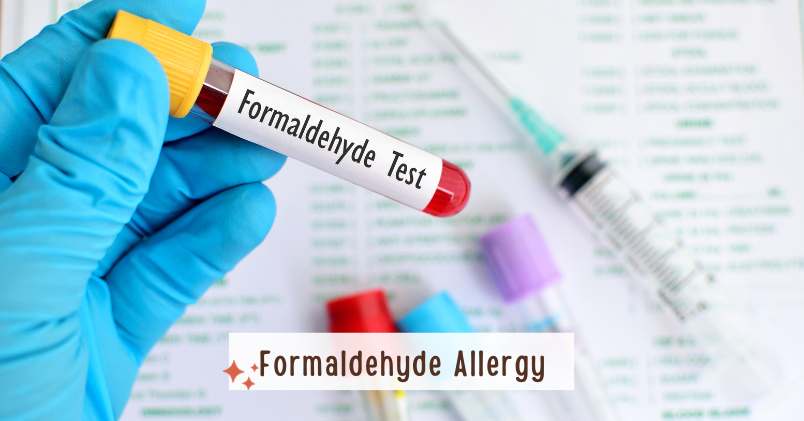 Formaldehyde Allergy