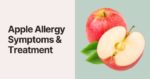 Apple Allergy - Facts, Symptoms, and Treatment