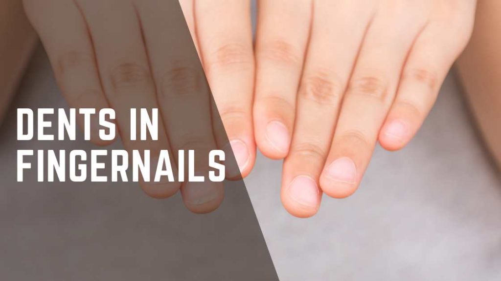 Dents in Fingernails