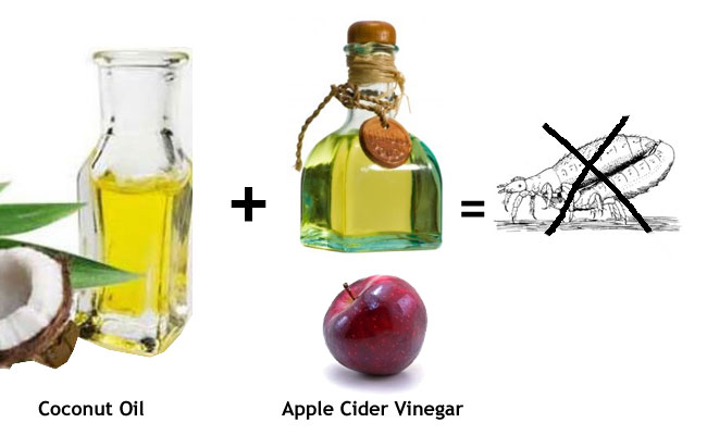 Apple Cider Vinegar And Coconut Oil For Lice