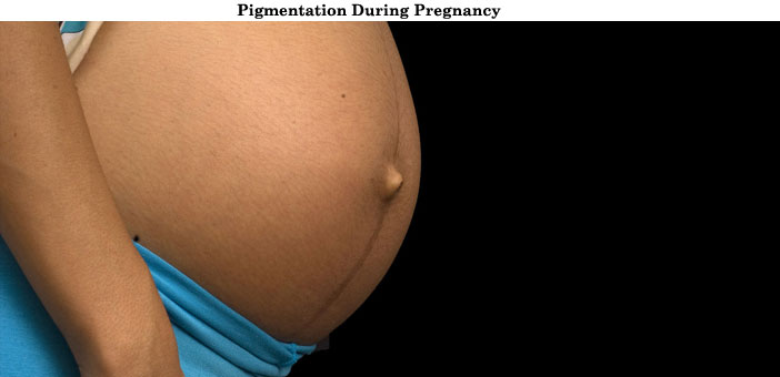Pigmentation During Pregnancy