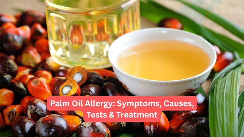 Palm Oil Allergy