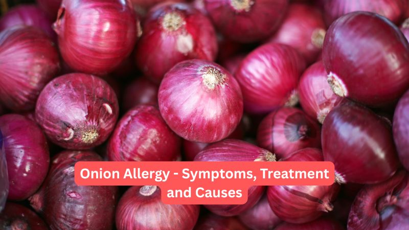 Onion Allergy Symptoms, Treatment and Causes