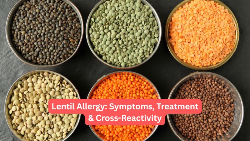 Lentil Allergy